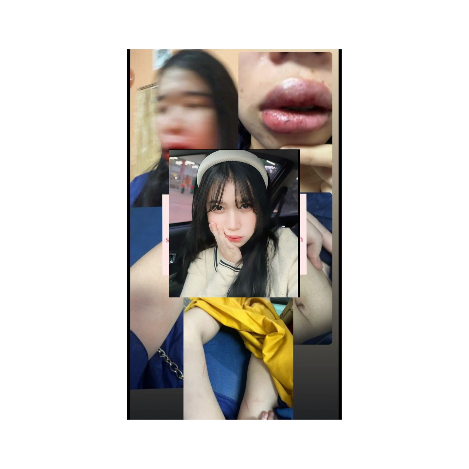 Viral !!! Seorang Wanita Dapat Kekerasan Seksual.